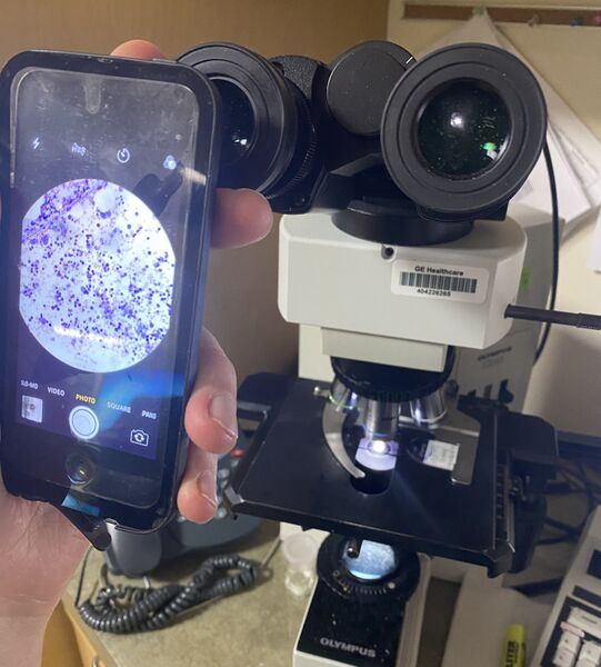 File:Micrography with a smartphone 2.jpg