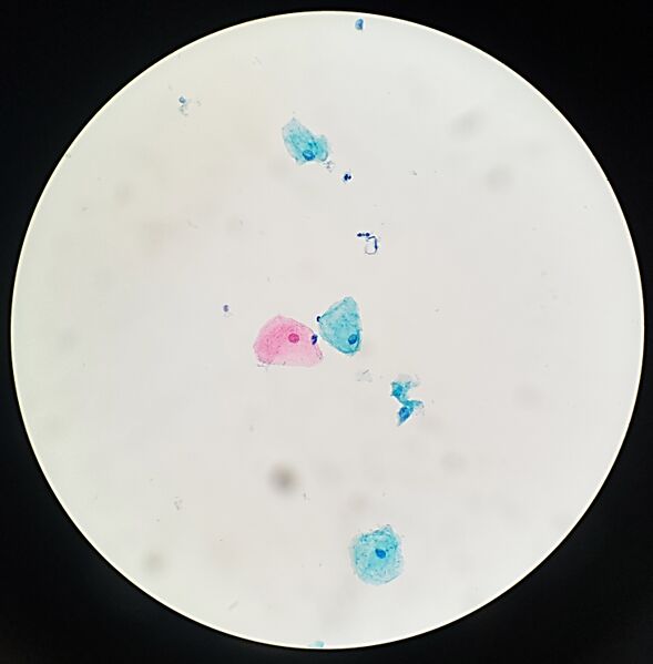 File:Adequacy counting of pap test.jpg