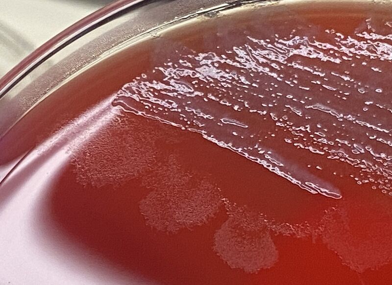 File:Early Proteus-looking colonies.jpg