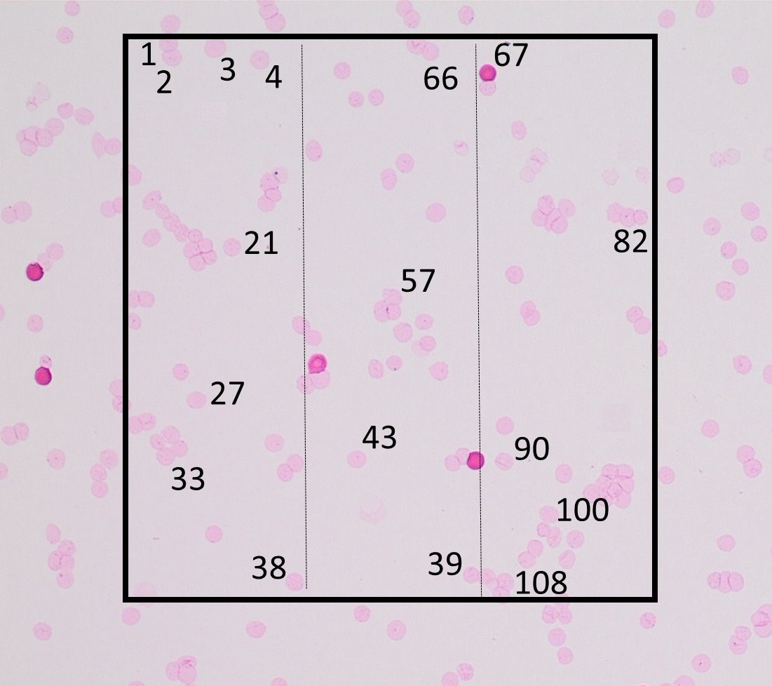 A third area of the same size yields a count of 108 cells, deviating 8 from 100. The standard deviation used[note 2] is therefore the mean of 6 and 8, which is 7. As per the table, one more area needs to be counted.