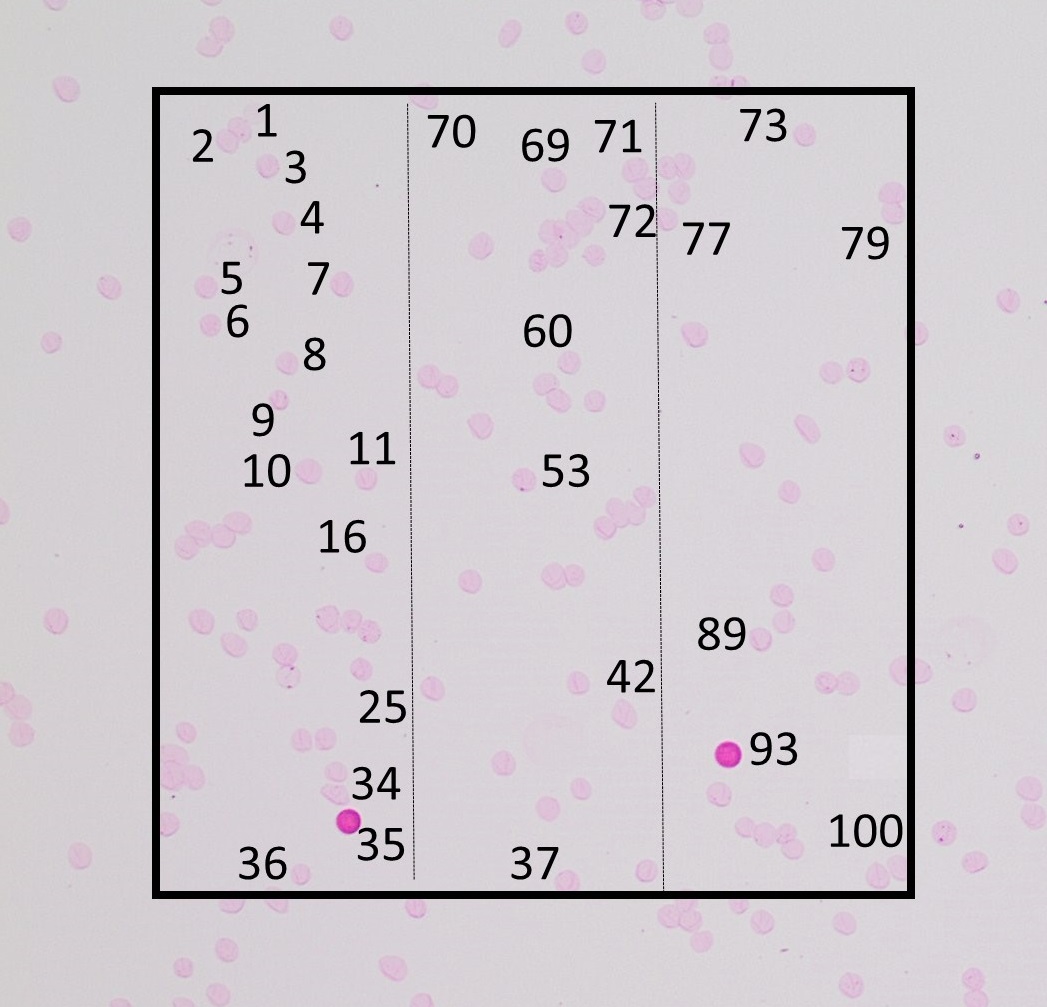 100 cells are counted, and their area is marked with a rectangle.