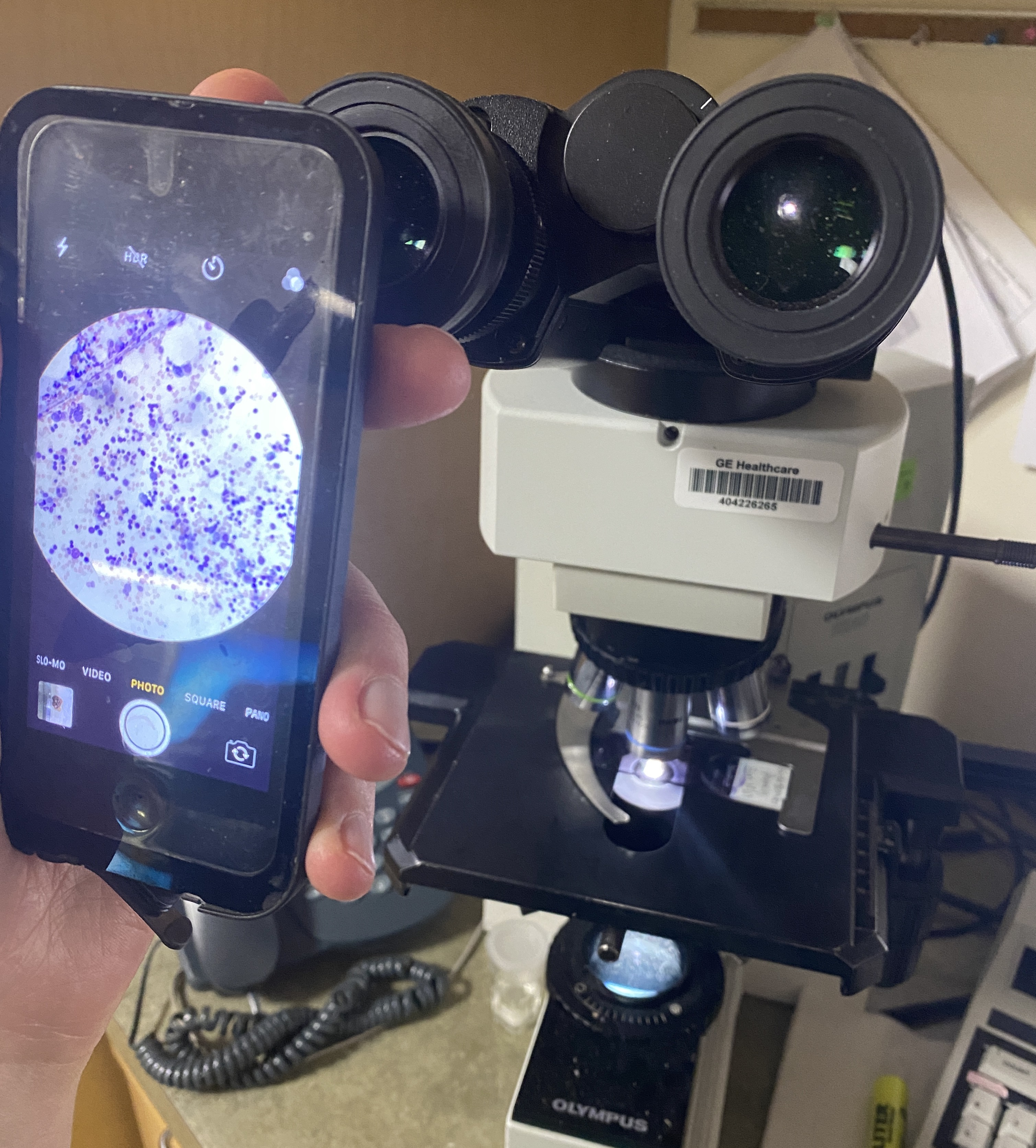 ...and then slowly move the smartphone closer to the eyepiece, while adjusting both direction and location so as to keep the bright circle in the center of the display, until the camera is able to focus and you have a visible field that is large enough for evaluation, and then take your photos.