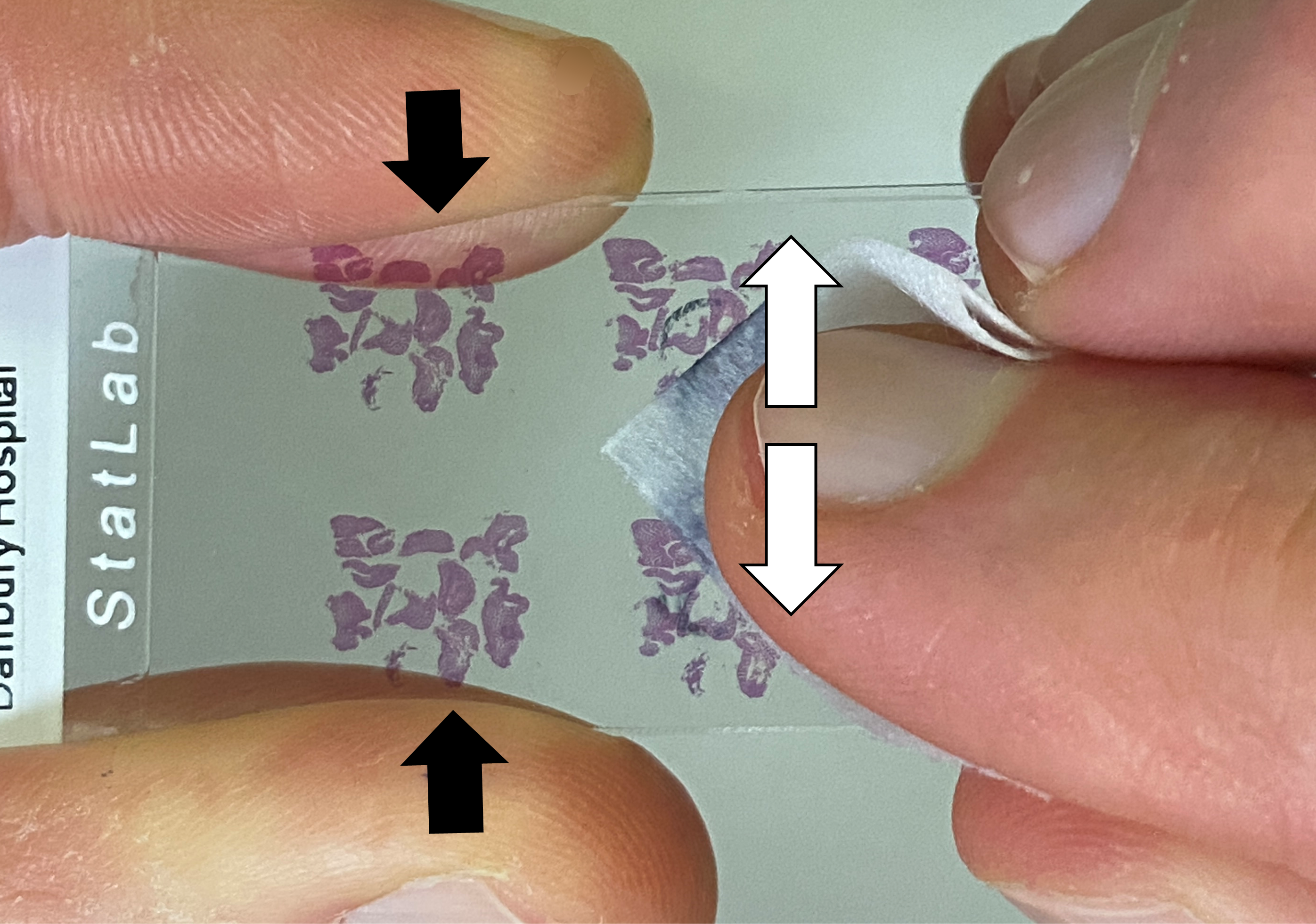 You can generally remove marks from a microscopy slide by using alcohol. Hold the cover slip in place with two fingers while wiping from side to side, to avoid the risk of moving the coverslip. Don't press hard against the glass, as it may disrupt the tissue.